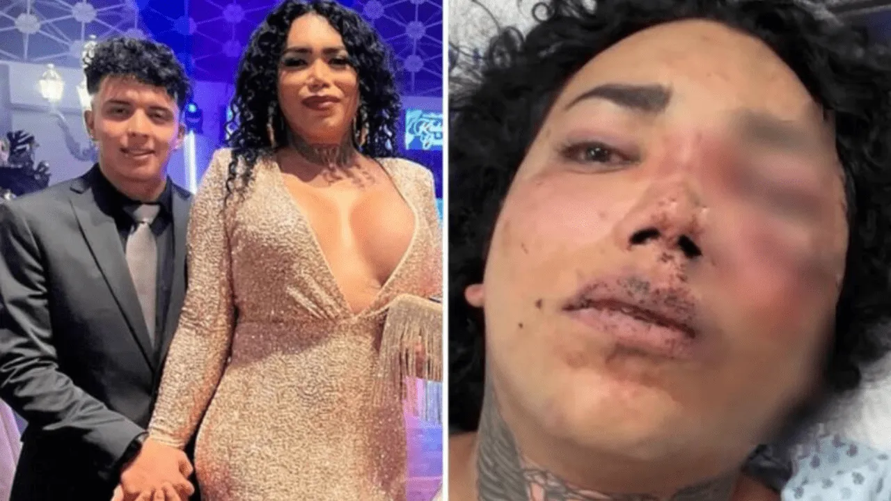 Paola Suarez a punto de perder el ojo