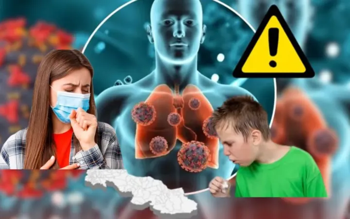 Aumento de Casos de Tos Ferina en México: La Enfermedad Respira con Fuerza en 2025